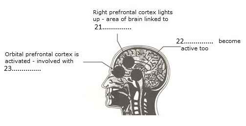 ielts reading sample - areas of the brain activated by jokes